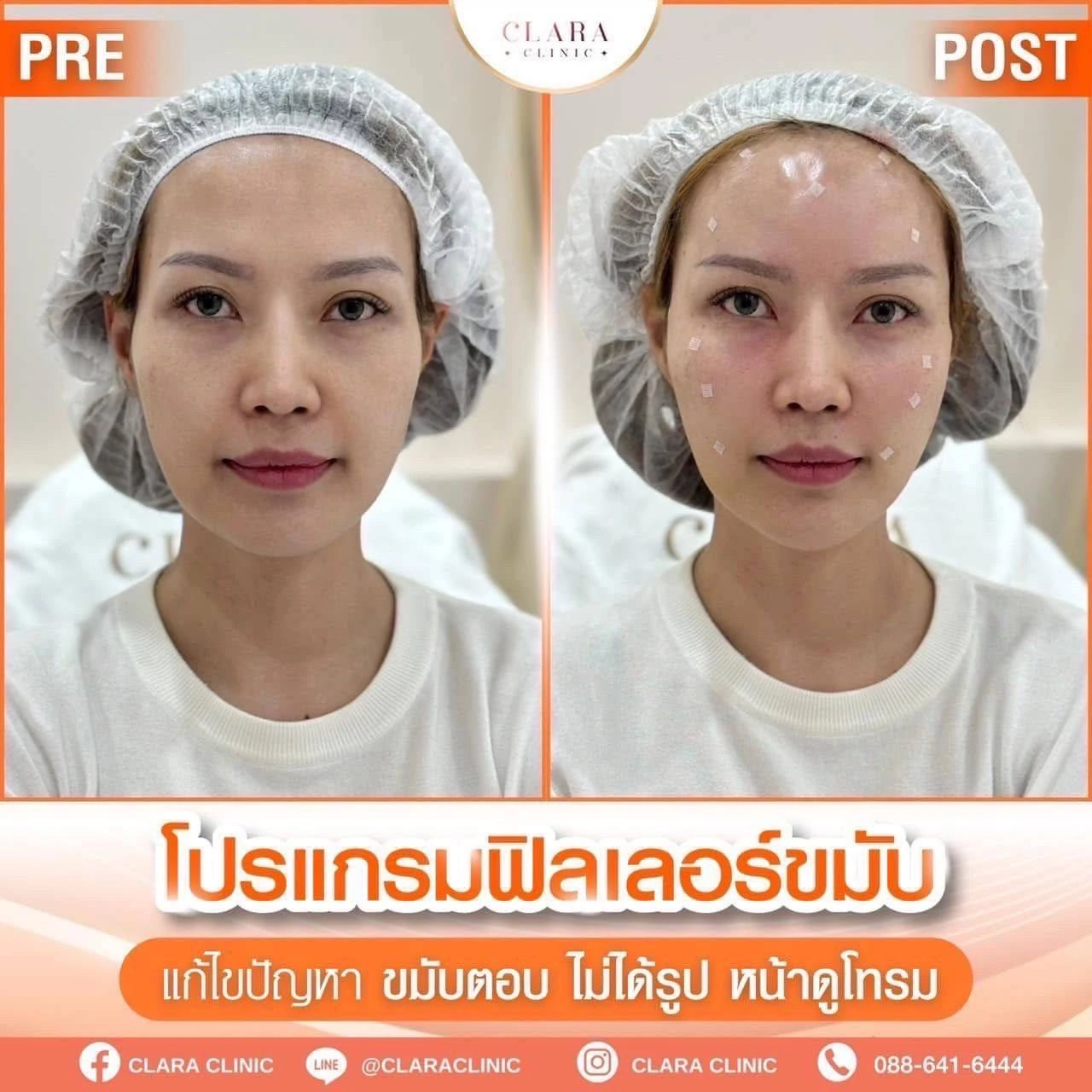 CLARA Review