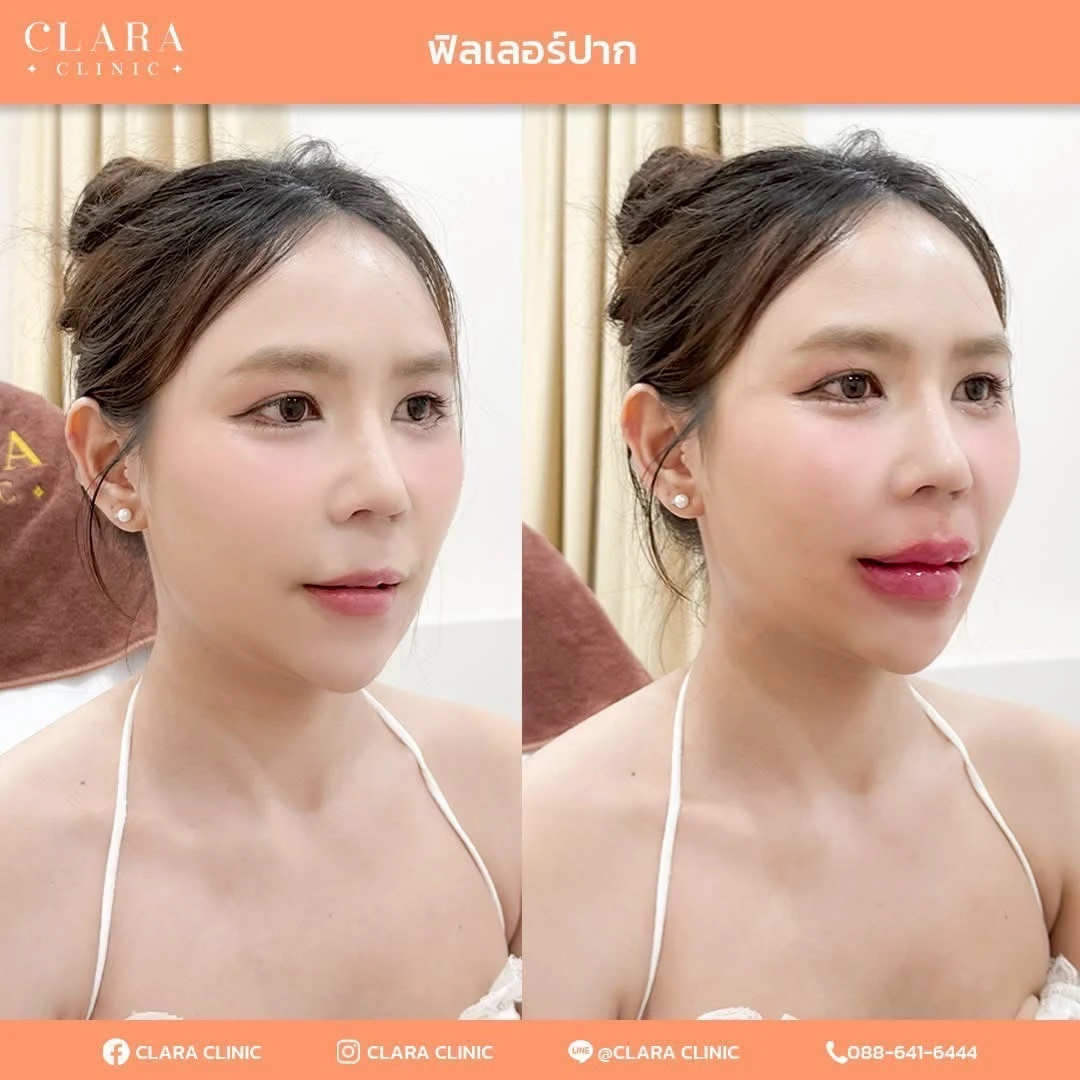 CLARA Review