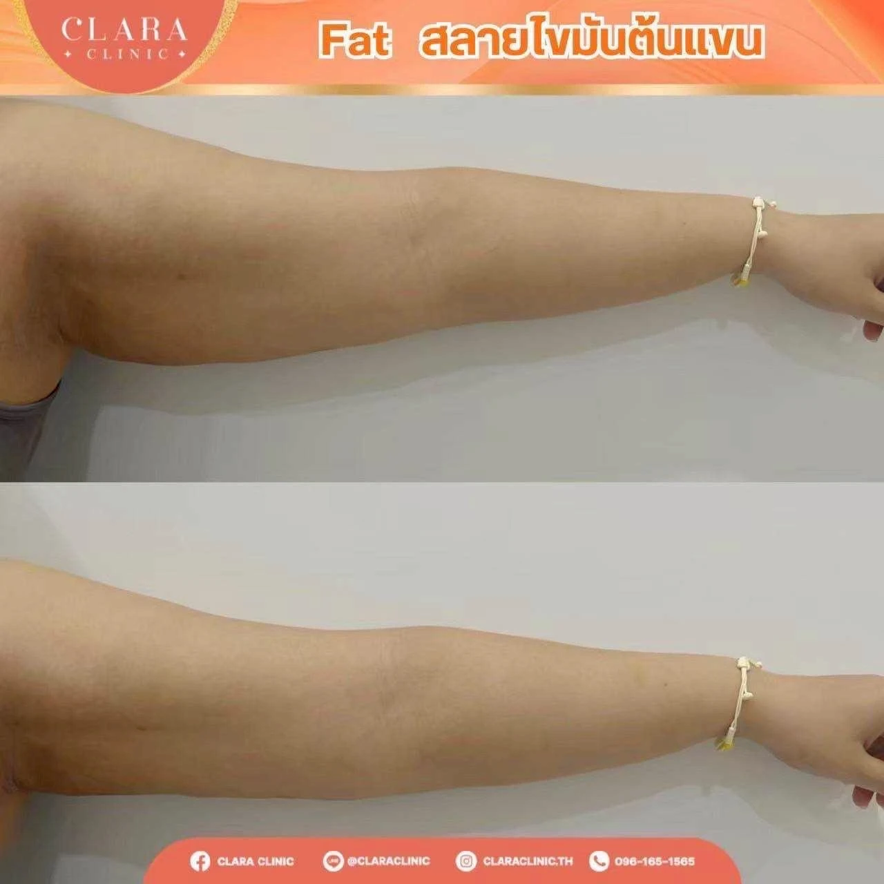CLARA Review