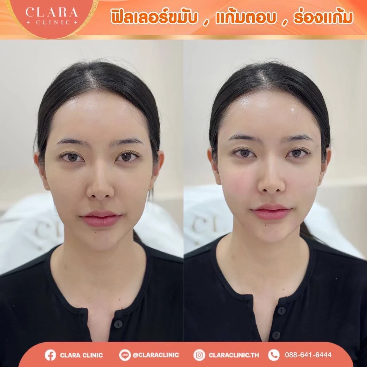 CLARA Review
