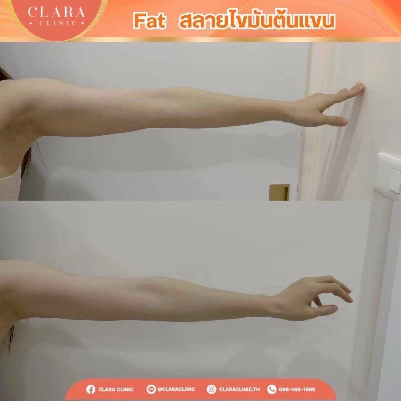 CLARA Review