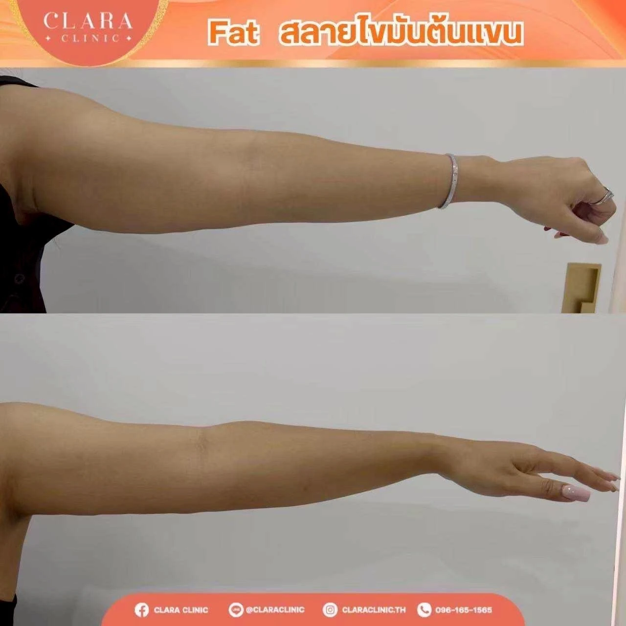 CLARA Review