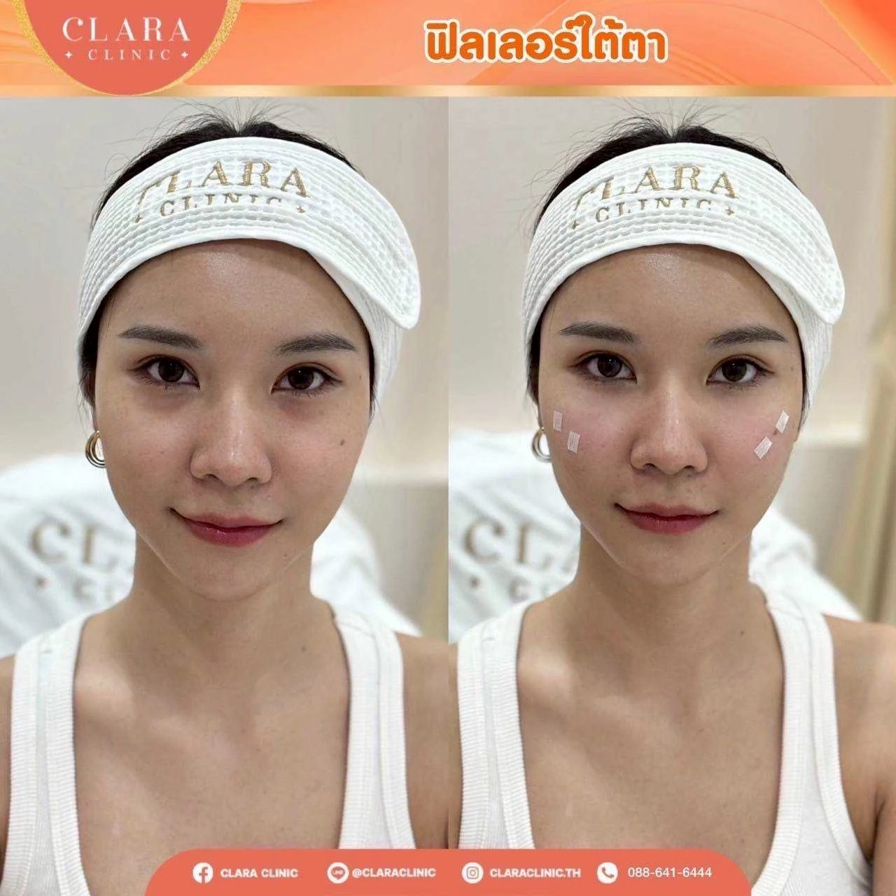 CLARA Review