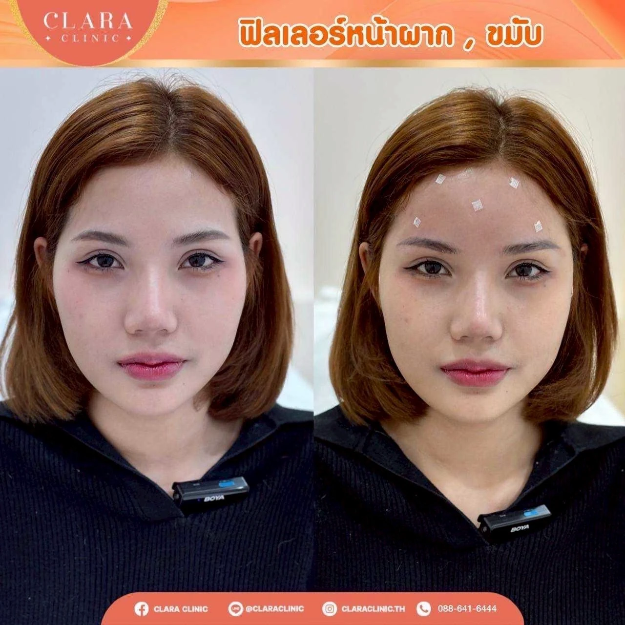 CLARA Review