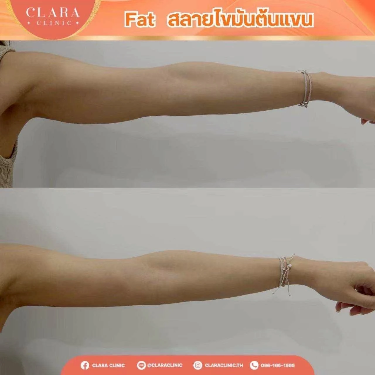 CLARA Review
