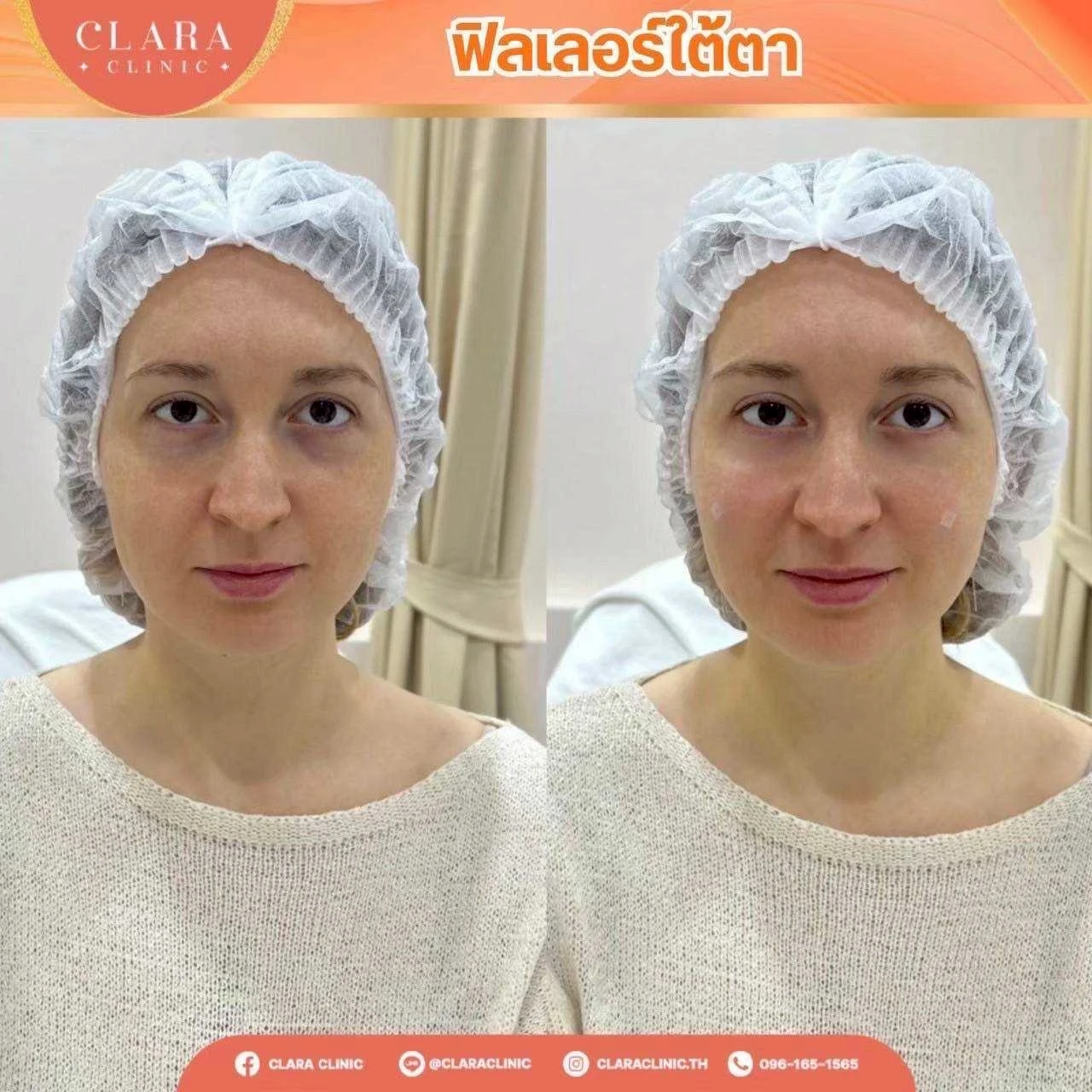 CLARA Review