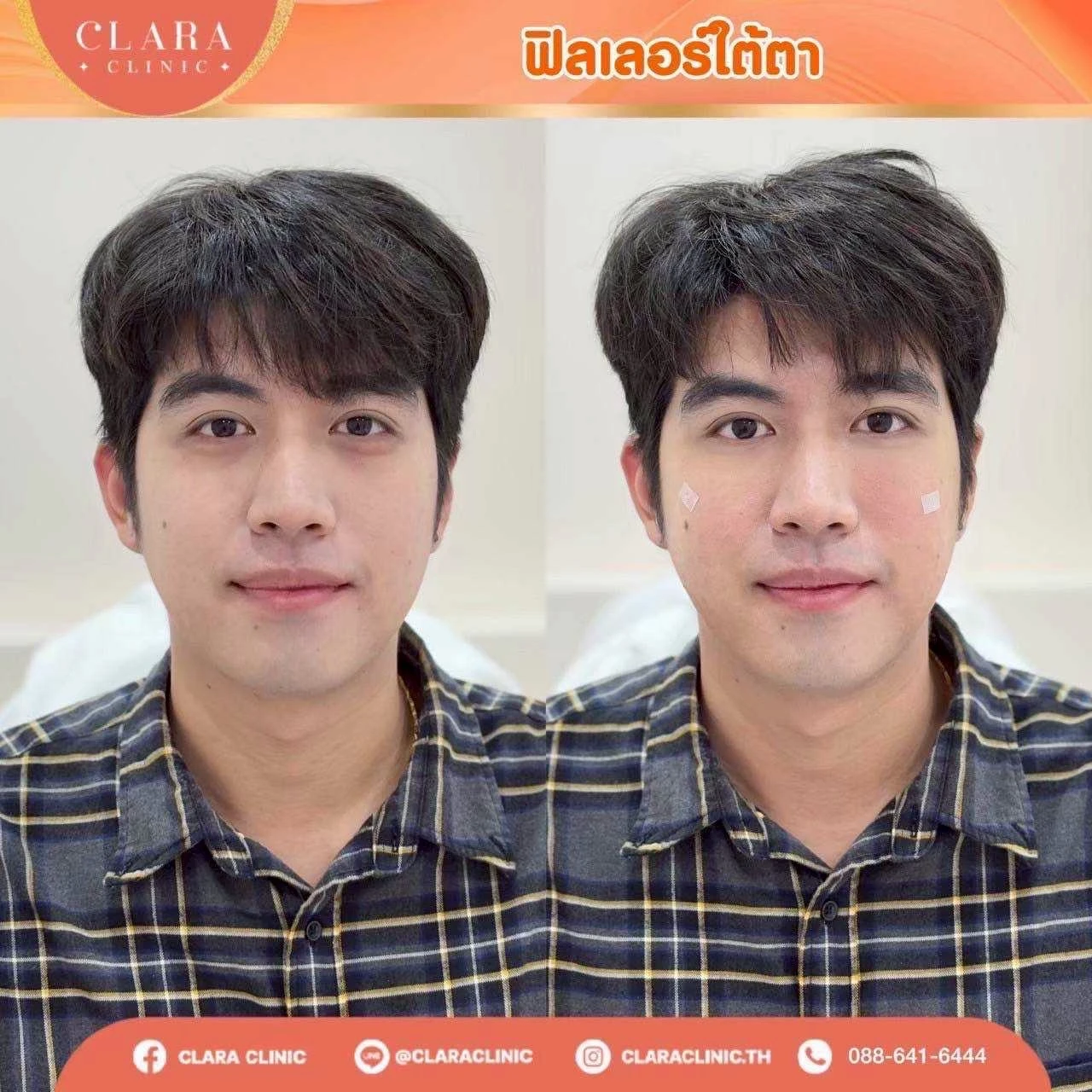 CLARA Review