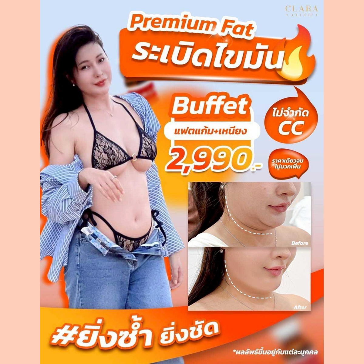 Promotion Image