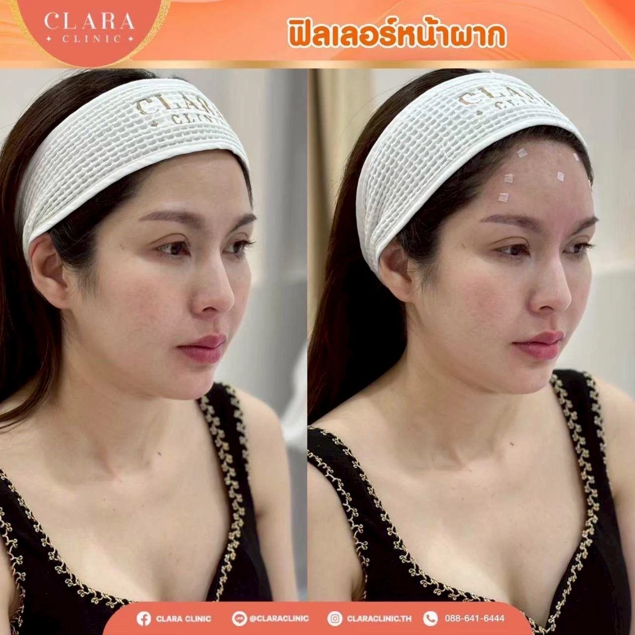 CLARA Review