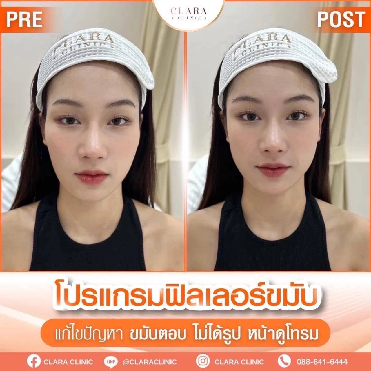CLARA Review