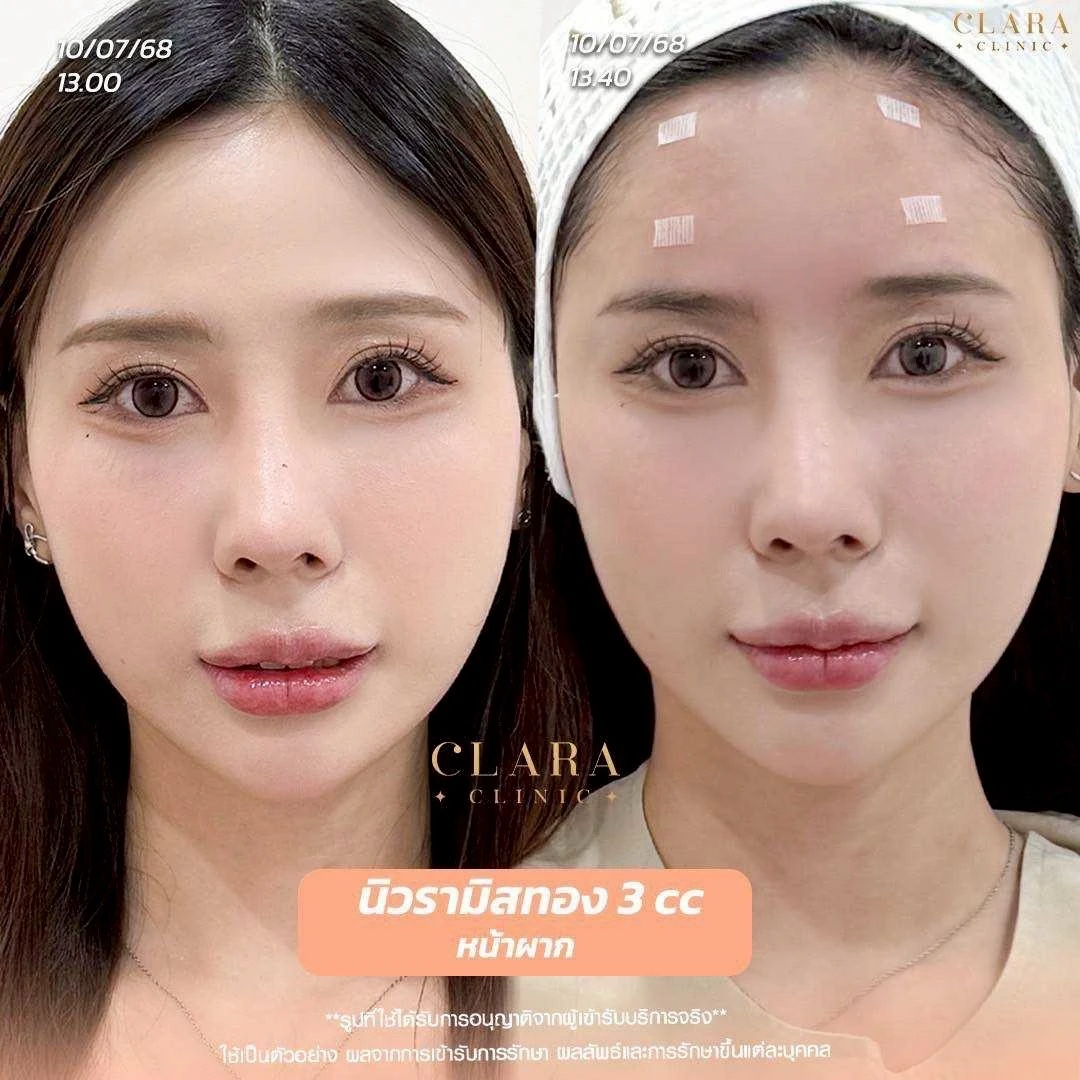 CLARA Review