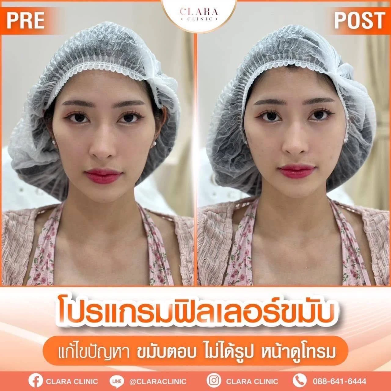 CLARA Review