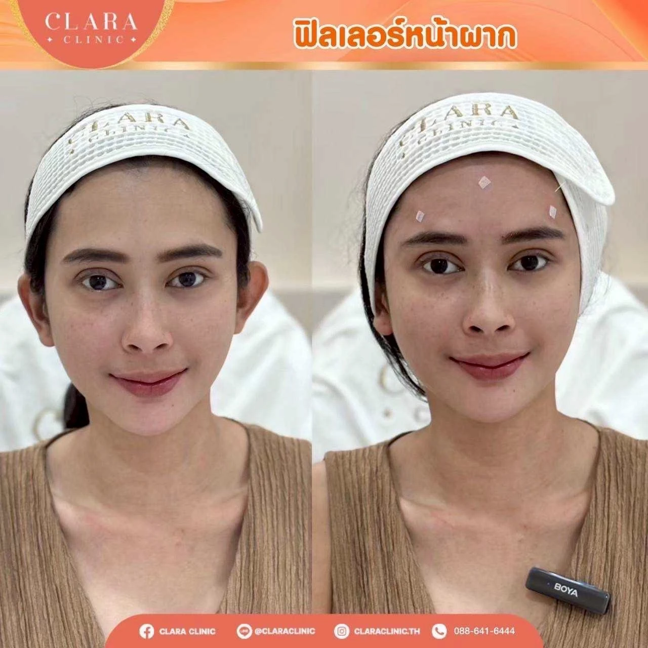 CLARA Review