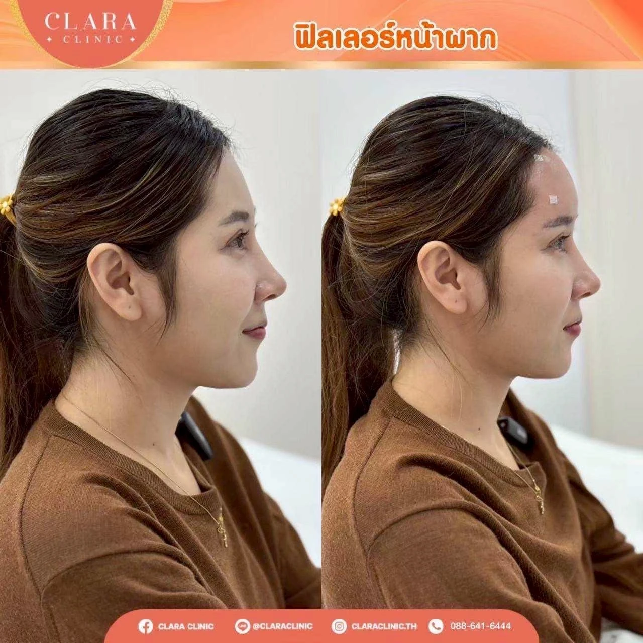 CLARA Review