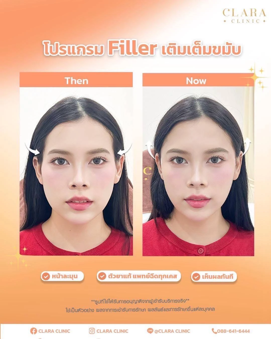 CLARA Review